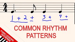 ECG Rhythm Review of 14 common rhythms [upl. by Keppel]