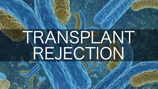 Transplant Rejection [upl. by Charissa]